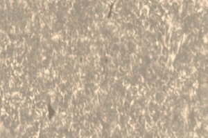 Oil Droplets Have Been Released After Centrifugation