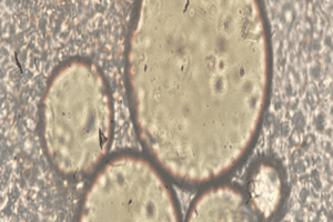 Oil Droplets Coalesce After Demulsifier Is Added